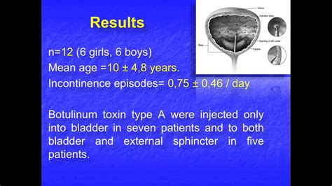 Ics Abstract Effectiveness Of Botulinum Toxin Type A