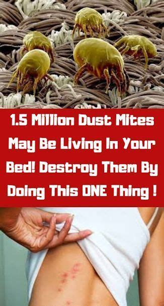 Did You Know Millions Of Dust Mites Live In Your Bed And You Could