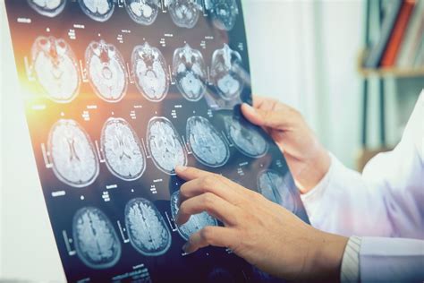 Mysterious Brain Disease Cluster Under Investigation In Canada Live