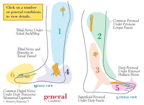 Nerve Pain Peroneal Nerve Pain In Knee