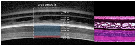 Oct B Scan Of The Retinal Layers In An Alert Chicken The Dashed Box