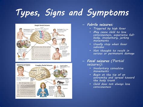 ppt seizure disorders powerpoint presentation free download id 2641250
