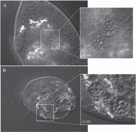 Nomarski Differential Interference Contrast Microscopy 600× Of A