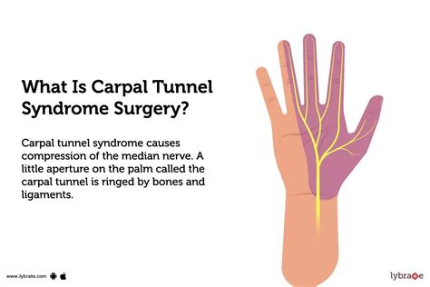Carpal Tunnel Syndrome Surgery Purpose Procedure Benefits And Side