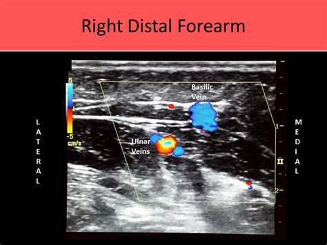 Ultrasound Registry Review Extremity Venous Vascular My Xxx Hot Girl