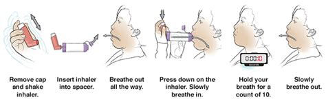 Discharge Instructions Using A Metered Dose Inhaler Saint Lukes