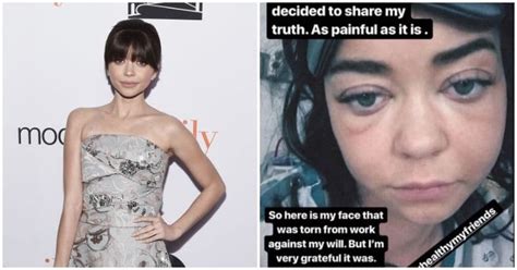 Sarah Hyland Hospitalized Star Shares Pictures Of Swo Vrogue Co