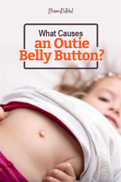 How To Get Rid Of An Outie Belly Button Naturally Means Waisenly
