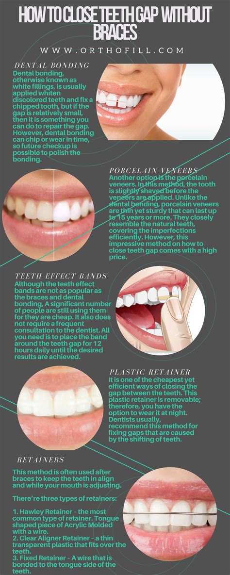 Check spelling or type a new query. How to close a gap between front teeth at home > MISHKANET.COM