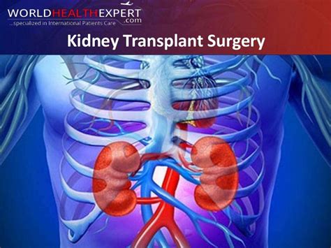 Kidney Transplant Surgery Procedure