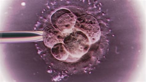Three Person Ivf Is Ethical To Treat Mitochondrial Disease Bbc News