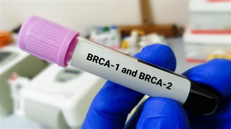 Brca Genes And Womens Cancer Risk Halo Diagnostics