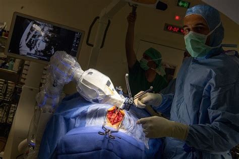 Lexington Medical Centers Robot Assists Surgeons Interesting Facts