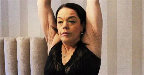 Emmerdales Lisa Riley Lost 12st But Needed Four Terrifying Surgeries To Fix Side Effect