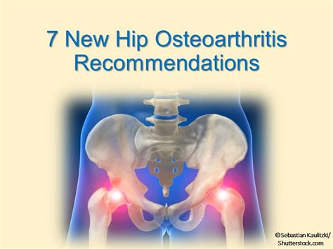 7 New Hip Osteoarthritis Recommendations Patient Care Online