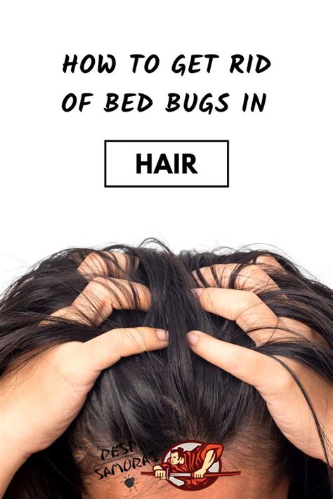 How To Get Rid Of Bed Bugs In Hair Easy Instructions Rid Of Bed
