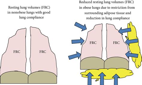 Functional Residual Capacity What All You Need To Know