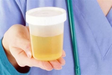 Tudo Sobre o Que a Cor da Urina pode Revelar Sobre a Sua Saúde