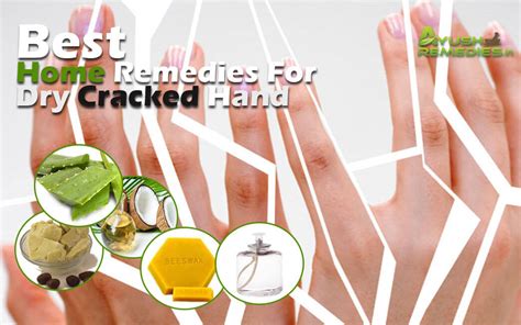 4 Natural Home Remedies For Dry Cracked Hands Get Rid Of Rough Hand