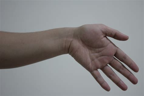 Wristhandfingersbendingulnar Deviation Free Image From