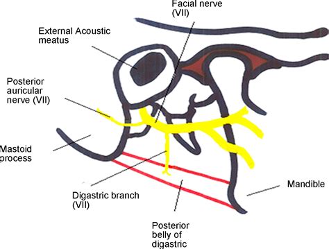 Posterior Auricular Nerve Found Anterior To The Cartilage Of The