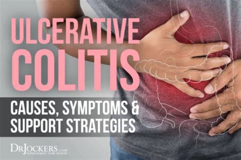 Ulcerative Colitis Causes Symptoms And Support Strategies