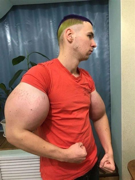 Meet Kirill Tereshin Real Life Popeye Who Injected Synthol In His Cheeks