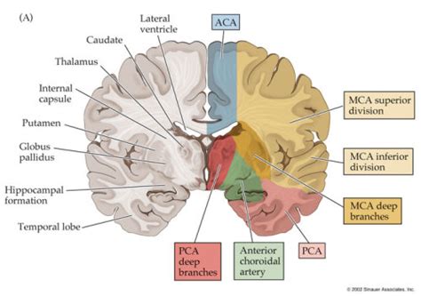 Anterior Cerebral Artery Aca Middle Cerebral Nervous System