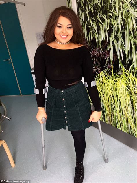 Teen With Incurable Bone Cancer Ditches Her Prosthetic Leg Daily Mail Online