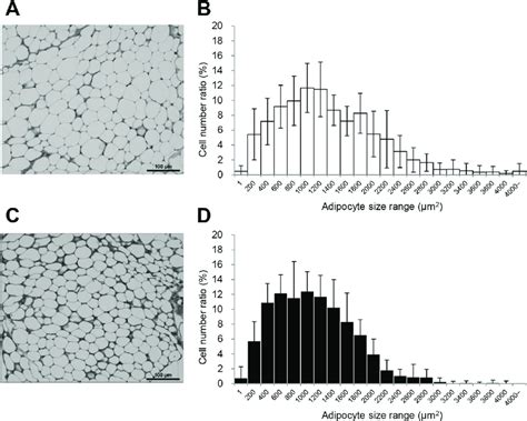 Adipocyte Size In White Adipose Tissue Representative Photomicrographs