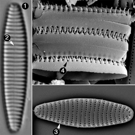 Stauroforma Exiguiformis Species Diatoms Of North America Diatom