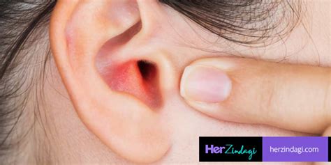 Symptoms And Home Treatment For Boil In Ear कान में फुंसी निकल आए तो