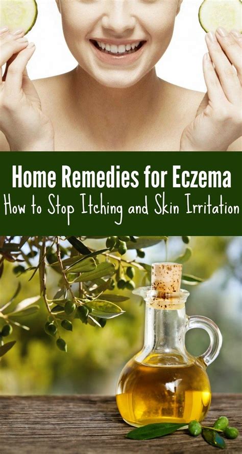Here 17 Home Remedies For Eczema How To Stop Itching And Skin Irritation