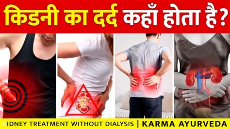 Kidney Pain Location On Body किडनी का दर्द कहाँ होता है Dr Puneet