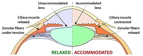 24 Schematic Representation Of The Accommodation Process Of The Eye