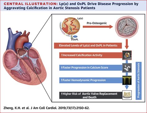 Lipoprotein A And Oxidized Phospholipids Promote Valve Calcification In Patients With Aortic