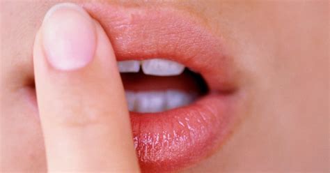 How To Prevent Dry Flaky Lips