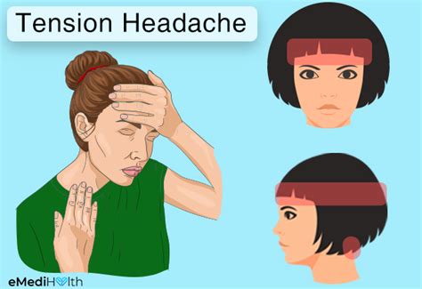 What Causes Tension Headaches And How To Treat Them