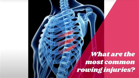 What Are The Most Common Rowing Injuries Youtube