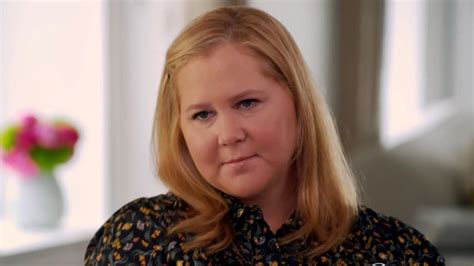 Amy Schumer Opens Up About Decades Long Battle With ‘lonely Disease