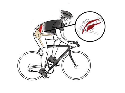 Managing Hip Pain While Cycling