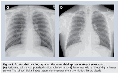 Contemporary Imaging Of The Pediatric Chest