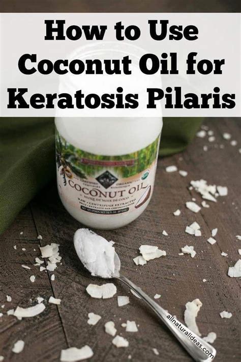 Coconut Oil For Keratosis Pilaris Coconutoilskincare