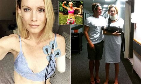 Stuntwoman Olivia Jackson Who Lost A Limb In On Set Accident Says How
