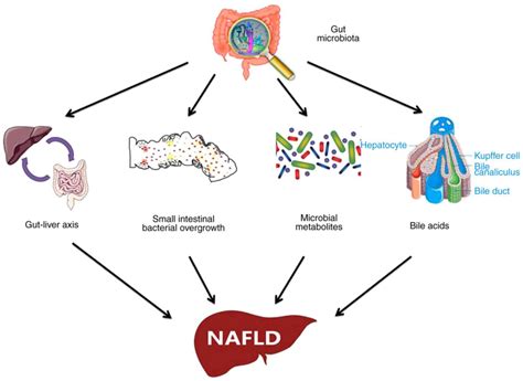Role And Effective Therapeutic Target Of Gut Microbiota In Nafldnash
