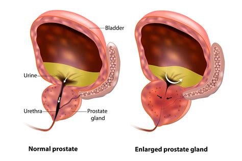Bladder And Prostate Anatomy