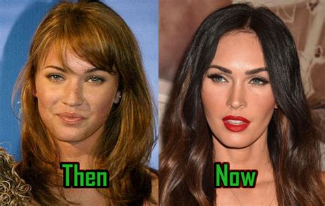 megan fox plastic surgery behind her drastic transformation before after celebritysurgeryicon