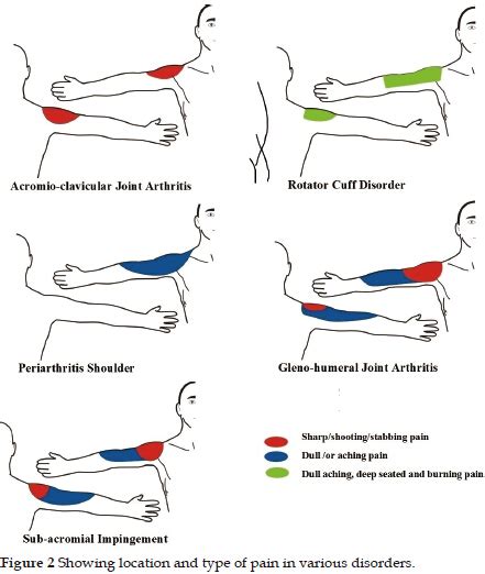 Shoulder Pain Location Chart
