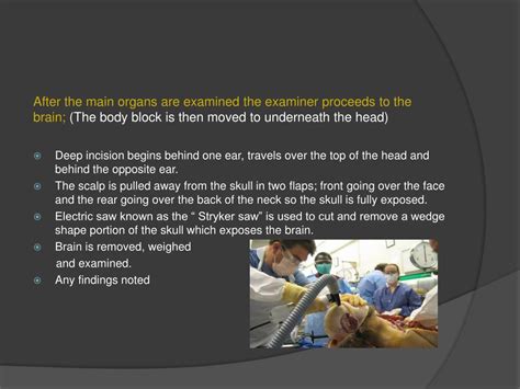Ppt Autopsies Powerpoint Presentation Free Download Id1555682