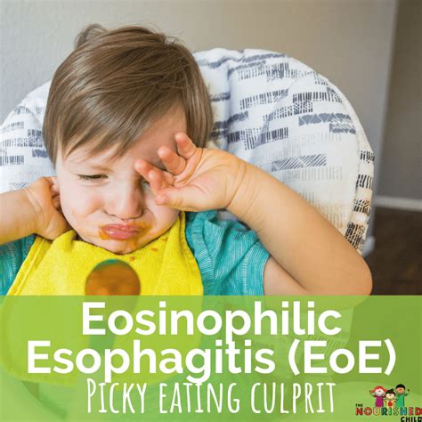 Eosinophilic Esophagitis Eoe In Children The Nourished Child